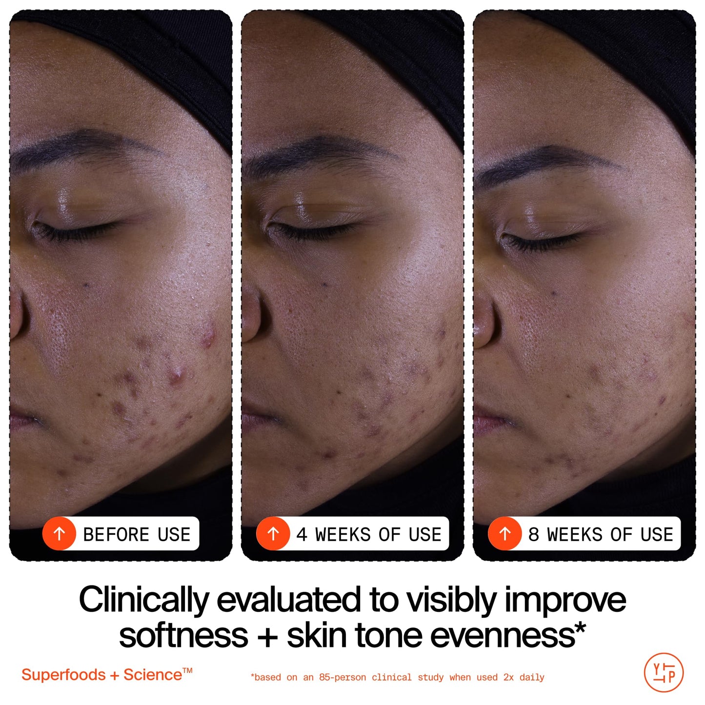 Youth To The People Superfruit Facial Cleanser - Papaya + Vitamin C Gentle Exfoliating Face Wash, Cellular Skin Renewal with AHA + BHA, Evens Skin Tone & Texture for Soft + Radiant Skin, Sulfate-free